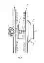 Fig. 03 - Bone clamping system