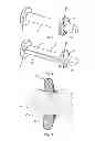 Fig. 07 - Bone clamping system
