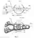 Fig. 02 - Bone plate with transversal slots for receiving a fastener