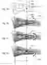 Fig. 07 - Bone plate with transversal slots for receiving a fastener