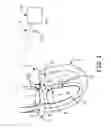 Fig. 02 - Preventing use of vagal stimulation parameters
