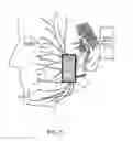 Fig. 06 - System and method for facial nerve stimulation