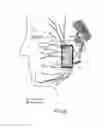 Fig. 07 - System and method for facial nerve stimulation