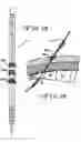 Fig. 09 - MINIMALLY INVASIVE METHODS FOR IMPLANTING A SACRAL STIMULATION LEAD