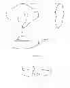 Fig. 02 - STAND-ALONE ELECTRONIC APPARATUS AND DEVICE FOR FASTENING THE LATTER TO AN ELECTRODE LOCATED ON THE HEAD OF A PATIENT FOR USE WHEN THE PATIENT IS LYING DOWN