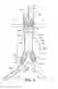 Fig. 07 - Systems and methods for guidewire crossover for bifurcated prostheses