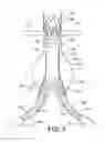 Fig. 08 - Systems and methods for guidewire crossover for bifurcated prostheses