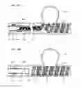 Fig. 08 - SYSTEMS FOR PERFORMING INTRALUMENAL RECONSTRUCTION