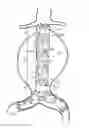 Fig. 01 - Stent-grafts with post-deployment variable radial displacement