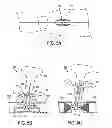 Fig. 05 - Blood perfusion device delivery system