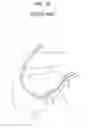 Fig. 02 - Drug eluting stent and a guide catheter device assembly for implanting the same