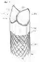 Fig. 06 - Low-profile heart valve and delivery system