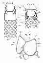 Fig. 07 - Low-profile heart valve and delivery system