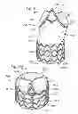 Fig. 08 - Low-profile heart valve and delivery system