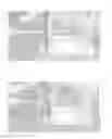 Fig. 06 - Retrieval and repositioning system for prosthetic heart valve