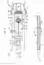 Fig. 05 - Staged deployment devices and methods for transcatheter heart valve delivery