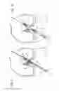 Fig. 06 - Method for creating a double bundle ligament orientation in a single bone tunnel during knee ligament reconstruction