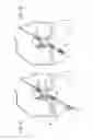 Fig. 07 - Method for creating a double bundle ligament orientation in a single bone tunnel during knee ligament reconstruction
