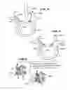 Fig. 04 - Facet arthroplasty devices and methods