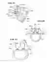Fig. 07 - Facet arthroplasty devices and methods