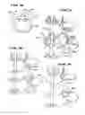 Fig. 08 - Facet arthroplasty devices and methods