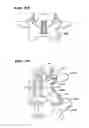 Fig. 09 - Facet arthroplasty devices and methods