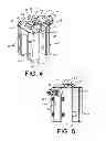 Fig. 03 - Instrumentation for recording and replicating orthopaedic implant orientation