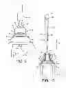 Fig. 05 - Instrumentation for recording and replicating orthopaedic implant orientation