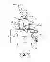 Fig. 06 - Instrumentation for recording and replicating orthopaedic implant orientation