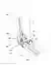 Fig. 01 - Elbow prosthesis