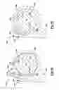 Fig. 43 - Elbow prosthesis