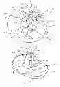 Fig. 01 - Constrained knee prosthesis