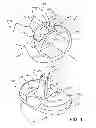 Fig. 02 - Constrained knee prosthesis