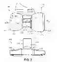 Fig. 03 - Constrained knee prosthesis