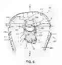 Fig. 06 - Constrained knee prosthesis