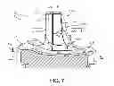 Fig. 08 - Constrained knee prosthesis