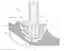 Fig. 01 - Patient-Matched Acetabular Component Alignment Device and Method