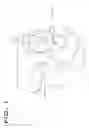 Fig. 02 - Patient-Matched Acetabular Component Alignment Device and Method