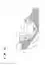 Fig. 07 - Patient-Matched Acetabular Component Alignment Device and Method
