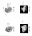 Fig. 07 - Gesture-Based Visualization System for Biomedical Imaging and Scientific Datasets