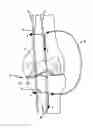 Fig. 01 - DETERMINING A RANGE OF MOTION OF AN ANATOMICAL JOINT