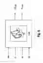 Fig. 06 - DETERMINING A RANGE OF MOTION OF AN ANATOMICAL JOINT