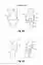Fig. 13 - DETERMINING A RANGE OF MOTION OF AN ANATOMICAL JOINT
