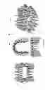 Fig. 24 - Electronic dental charting