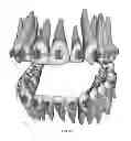 Fig. 33 - Electronic dental charting