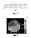 Fig. 02 - Visual analytics using multivariate concentric rings with a visual start time mechanism