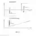 Fig. 06 - Tissue caliper