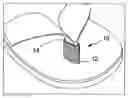 Fig. 01 - Toe Buddies Sandal Toe Guard