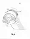Fig. 10 - Variable valve system to reduce condensation in a charge air cooler