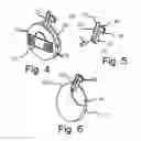 Fig. 06 - Concealed handcuff key